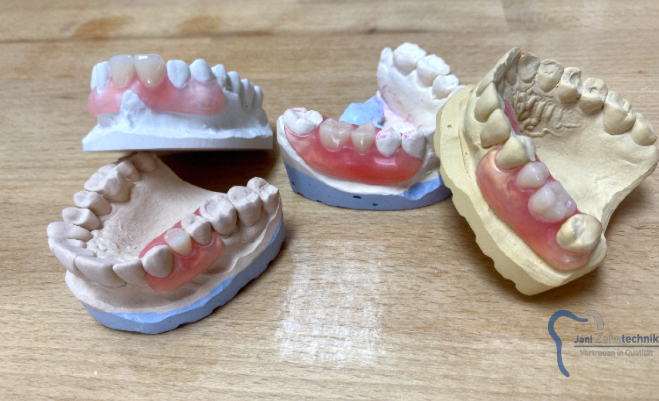 valplast