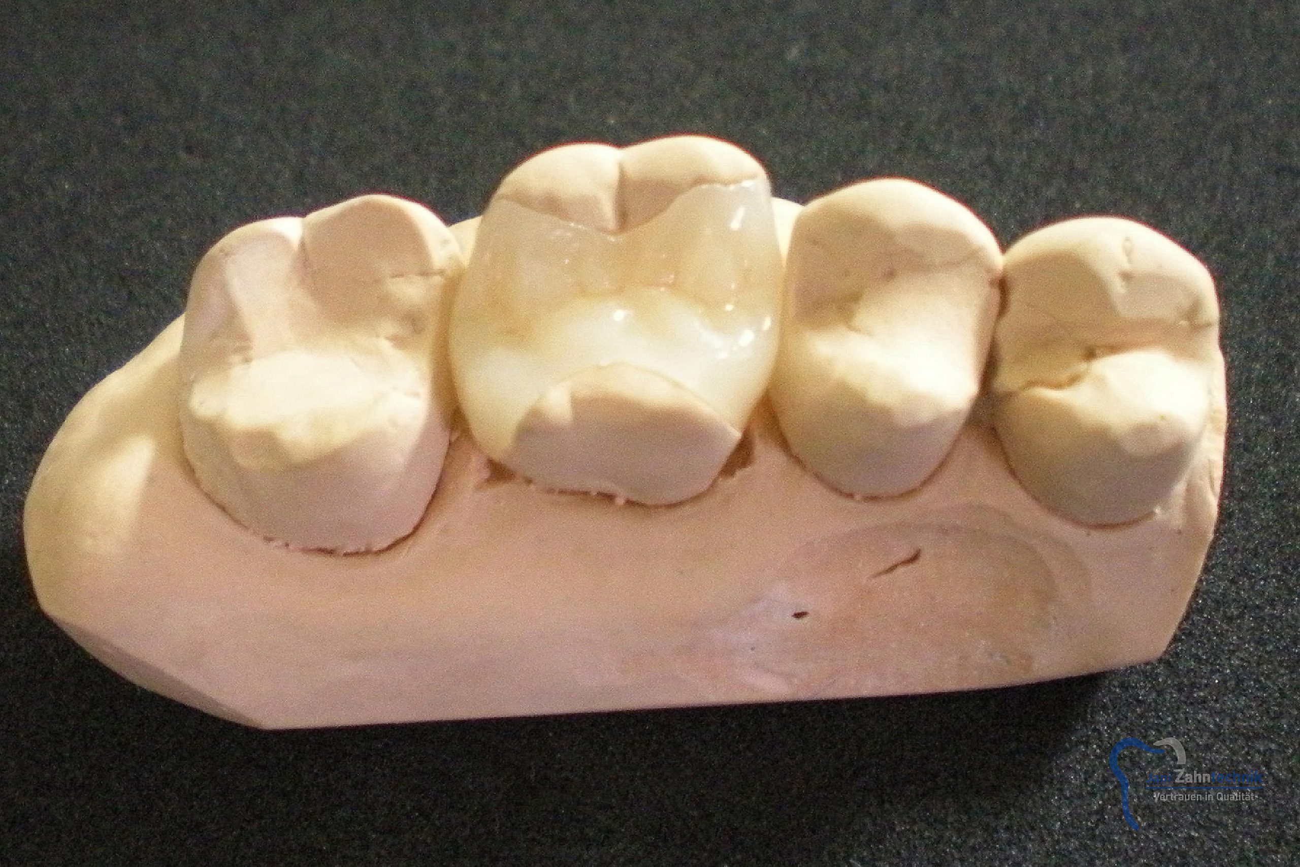 Inlay 2